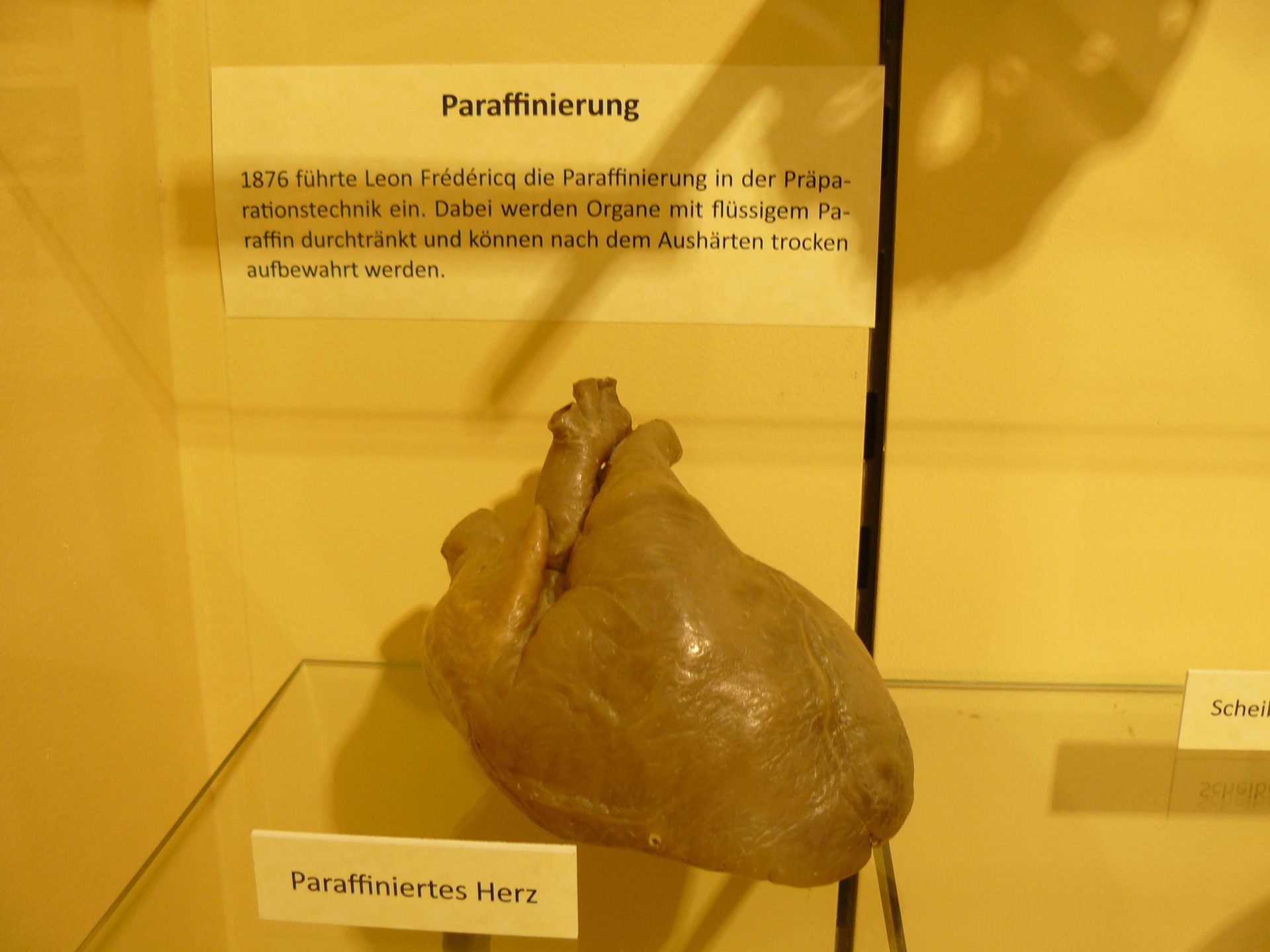anatomical models 3.jpg